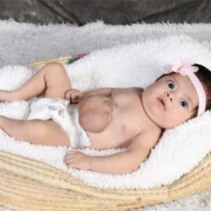 A photo of Marcela lying in a basket. Her heart is shown partially outside her chest cavity.