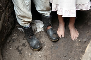 These feet belong to Andres, 7, and Fatima, 6. Andres and Fatima live with their family in a two-room shack on a remote mountainside in La Paera, Honduras.